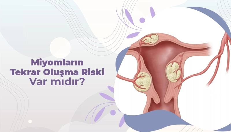 Miyomların Tekrar Oluşma Riski Var mıdır?