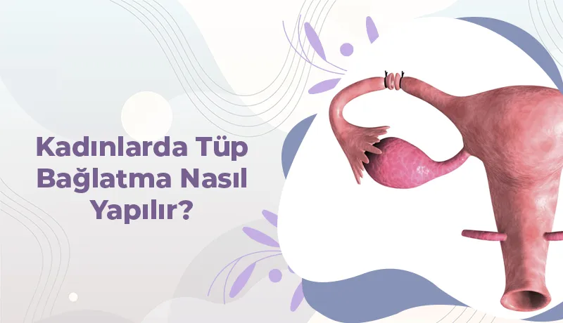 Kadınlarda Tüp Bağlatma Nasıl Yapılır? Tüp Ligasyonu Rehberi