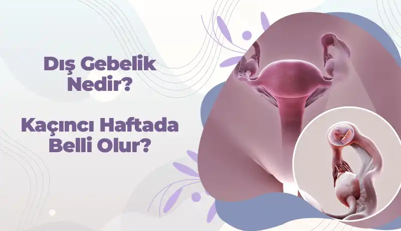 Dış gebelik nedir