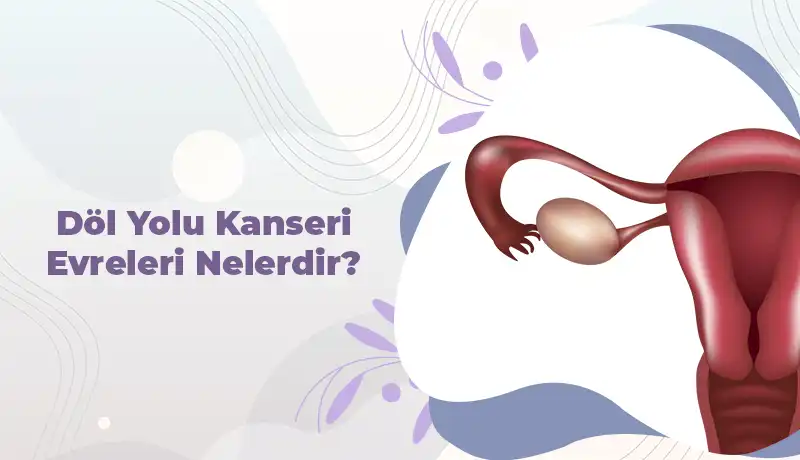 Döl Yolu Kanseri Evreleri Nelerdir?