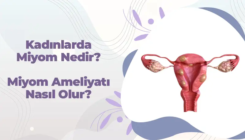 Kadınlarda miyom nedir içerik kapağı