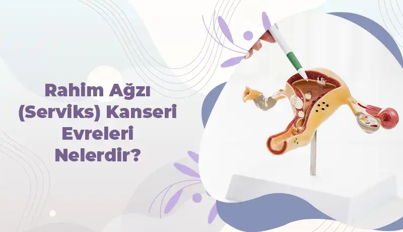 Rahim Ağzı (Serviks) Kanseri Evreleri Nelerdir?