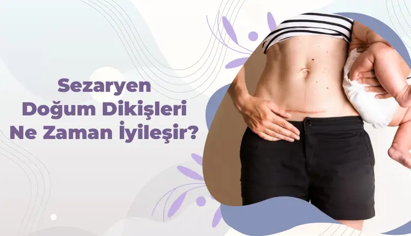 Sezaryen Doğum Dikişleri Ne Zaman İyileşir?