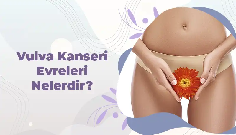 Vulva Kanseri Evreleri Nelerdir?