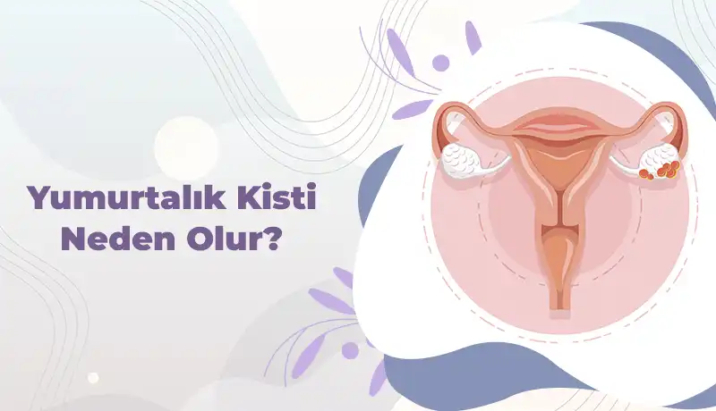 Yumurtalık kisti neden olur kapak