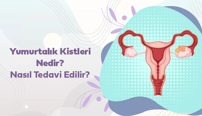 yumurtalık kisti nasıl tedavi edilir